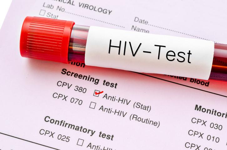 IICT Labs realizará -hoy- testeos masivos de HIV en Rosario
